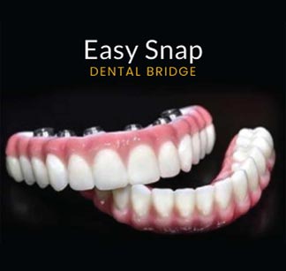Easy Snap Dental Bridge